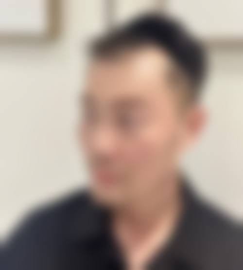 宁波亚植植发医院特色项目及技术优势