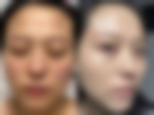 车炳勋院长的临床诊疗特色与优势