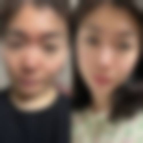 合肥大韩医疗美容门诊部求美者反馈