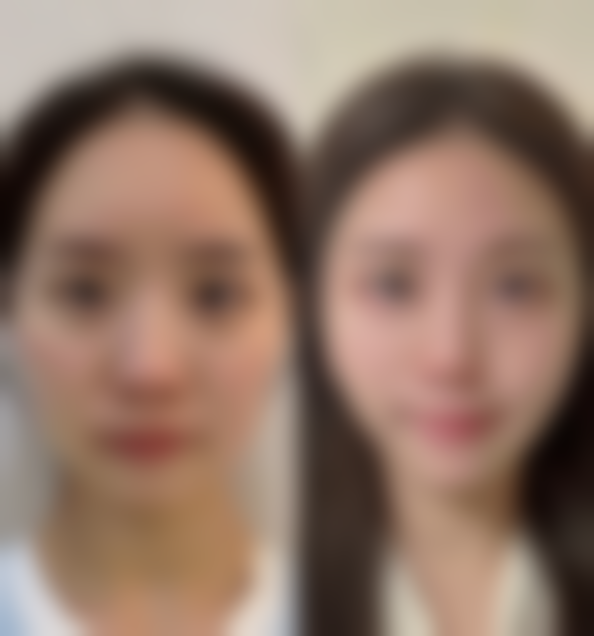 海阳韩雅美莱医疗美容门诊部求美者反馈