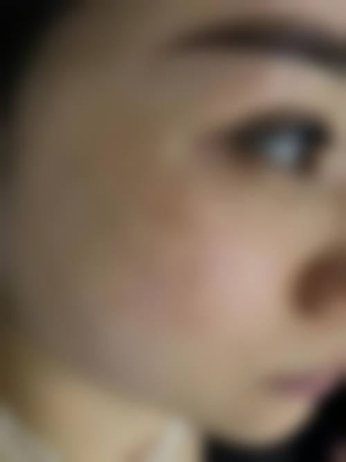 广西美丽之星美容医院求美者反馈