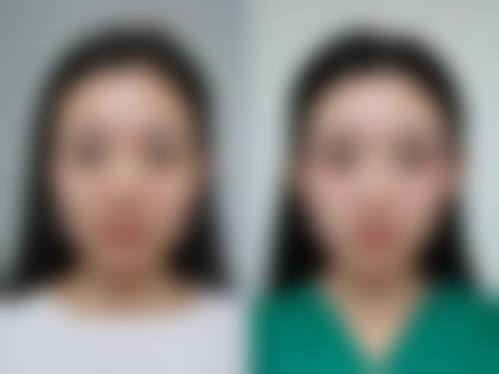 北京叶美人医疗美容整形医院求美者反馈