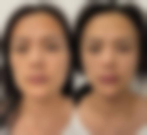 东莞天溯人（千寻）整形医疗美容门诊部求美者反馈
