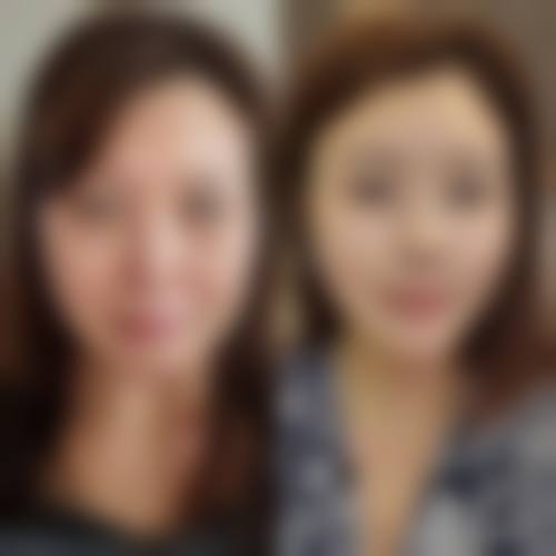 东莞天溯人（千寻）整形医疗美容门诊部价格收费