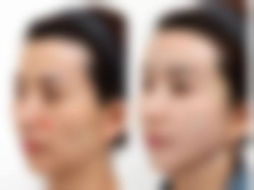 成都高新雅颜整形医院求美者反馈
