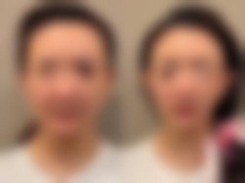 昆明炫美和谐医疗美容门诊部(原佳蒂)求美者反馈