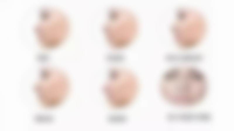 刘仁成医生的临床实例与求美者口碑