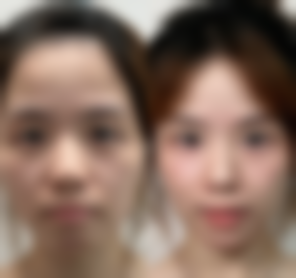 中山星念悦美医疗美容价格收费