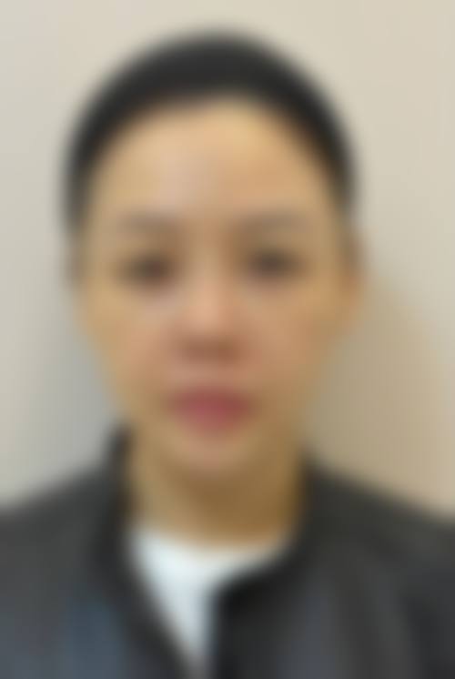 廊坊越星汇整形医院价格收费