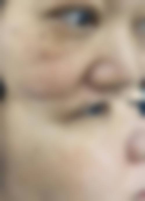 常立新医生秉持的安心养美理念