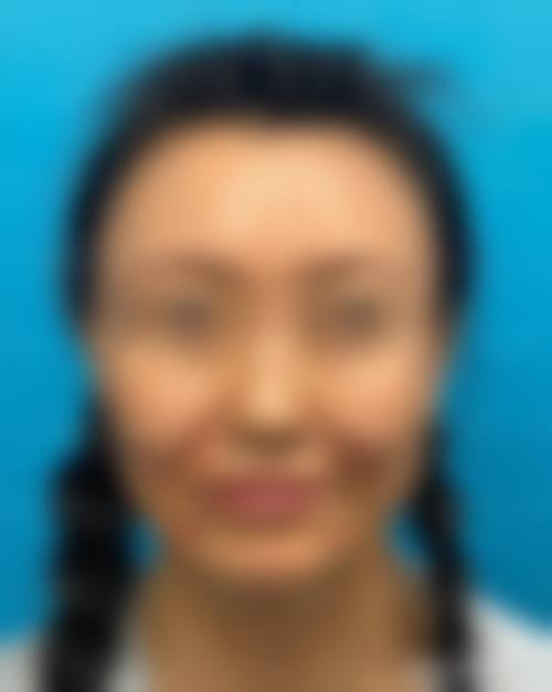 山东红十字会医院求美者反馈