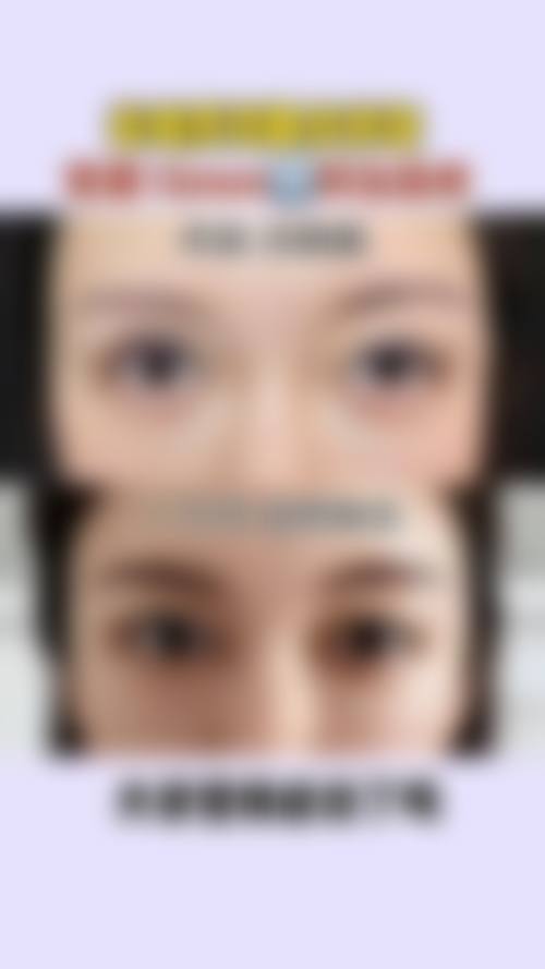 海南兰颜慧医学美容医院特色项目及技术优势