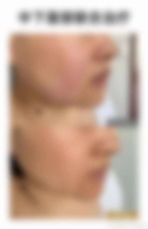 濮阳源美温赏医疗整形美容医院来院路线