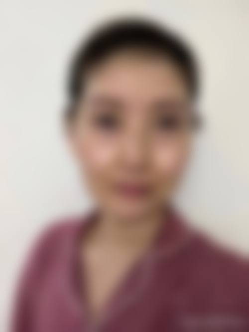 濮阳源美温赏医疗整形美容医院求美者反馈