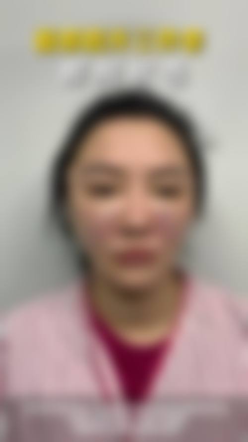 犍为九玺美诺拉整形医院价格收费