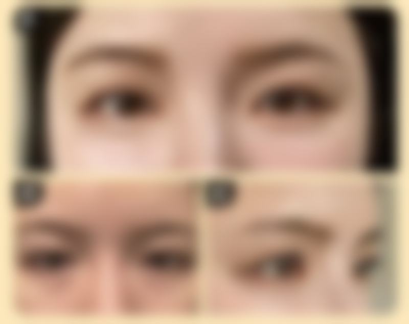 揭阳华美医疗美容医院求美者反馈