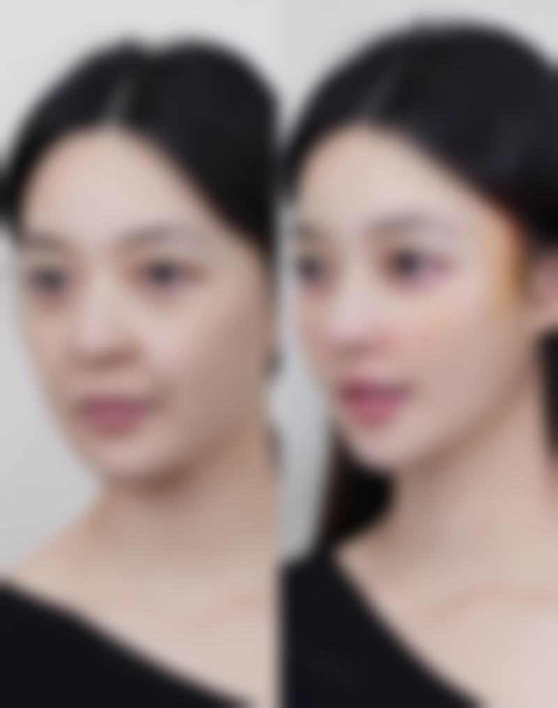 朴光珉医生依托的安心医美保护体系