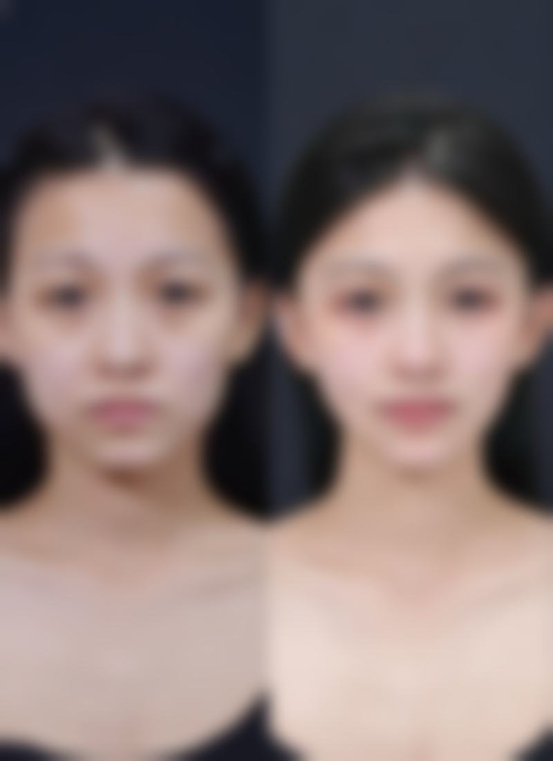 西安颜即一号医疗美容诊所求美者反馈