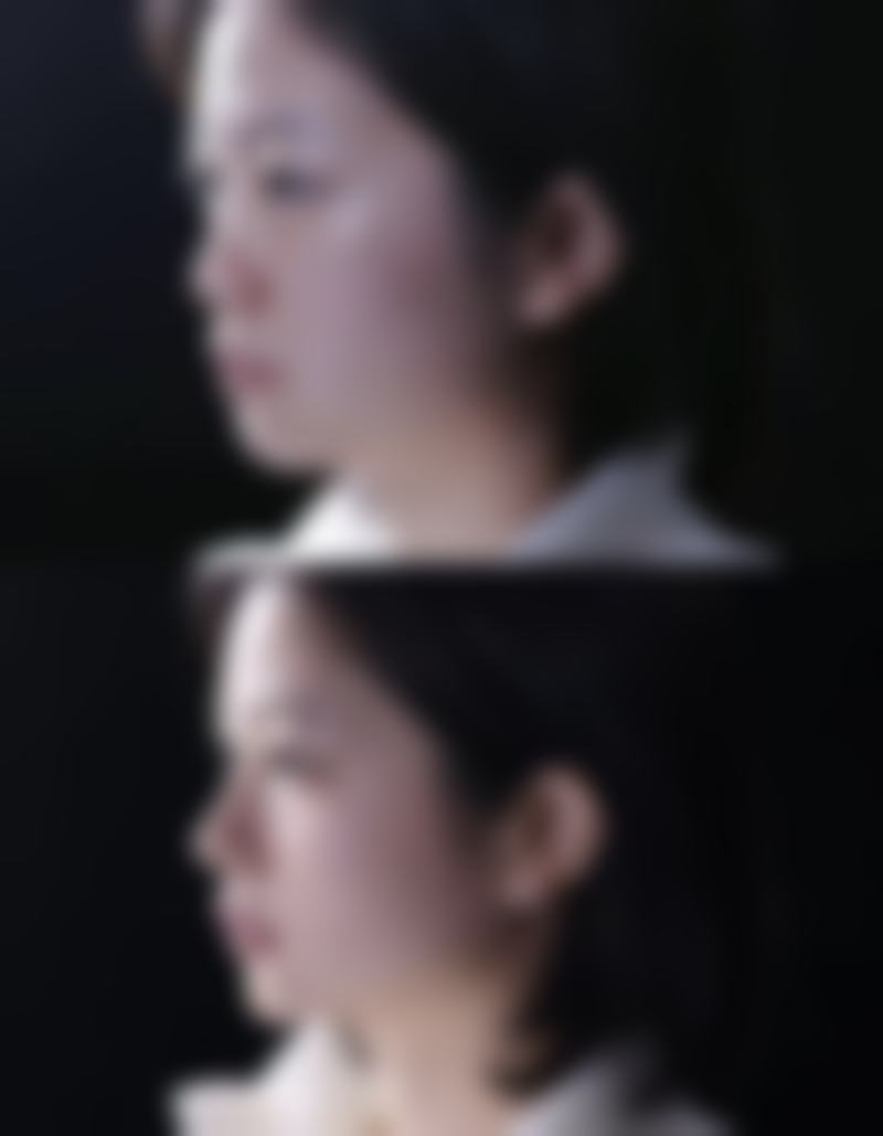 TCB东京中央美容外科横滨西口院求美者反馈