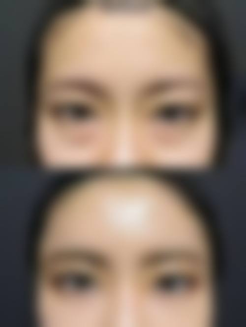 淄博春之樱整形医院求美者反馈