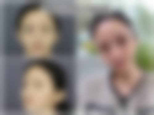 吉林吴丽娟医疗美容诊所求美者反馈