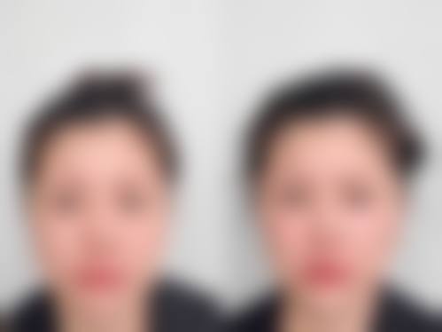 宁波悦之医疗美容诊所求美者反馈