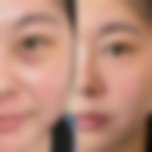 李元山医生的临床经验与团队支持