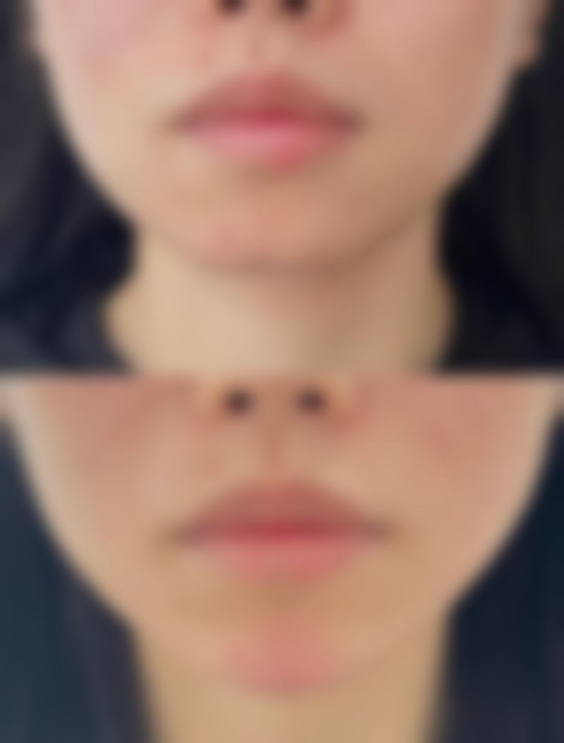 宁波悦之医疗美容诊所价格收费