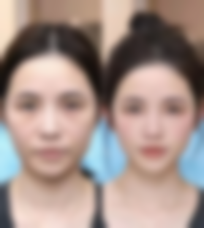 太原华美整形医院求美者反馈