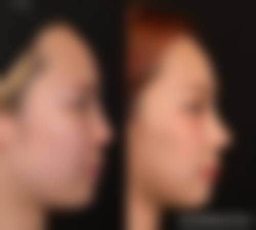 毛吉晓医生依托的安心医美技术体系