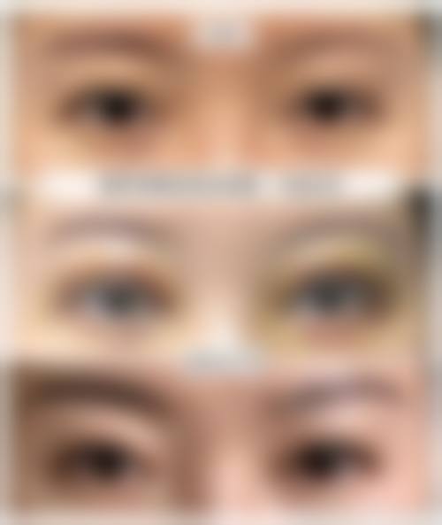 邢台伊美医疗美容医院特色项目及技术优势