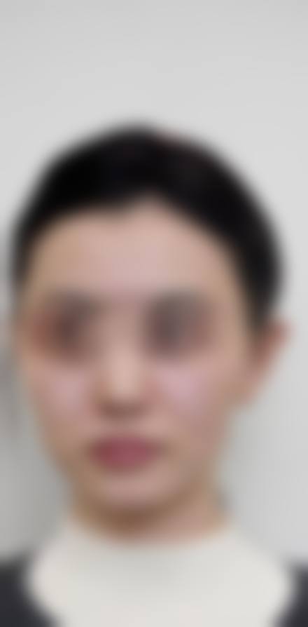 邢台伊美医疗美容医院求美者反馈