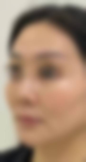 邢台伊美医疗美容医院价格收费
