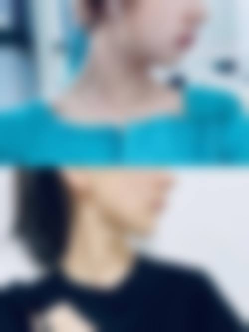杭州启美医疗美容医院求美者反馈