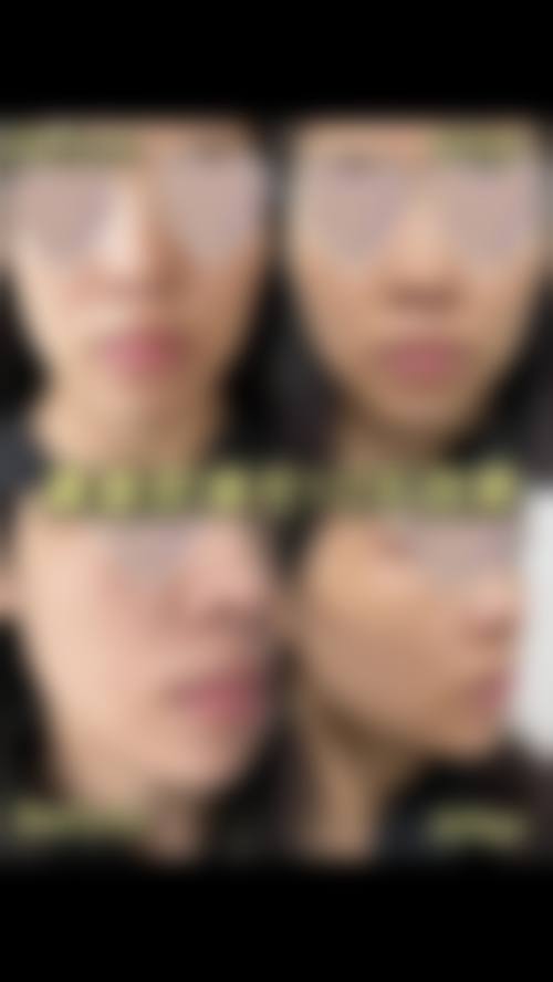武汉博仁圣缇雅医疗美容门诊部求美者反馈