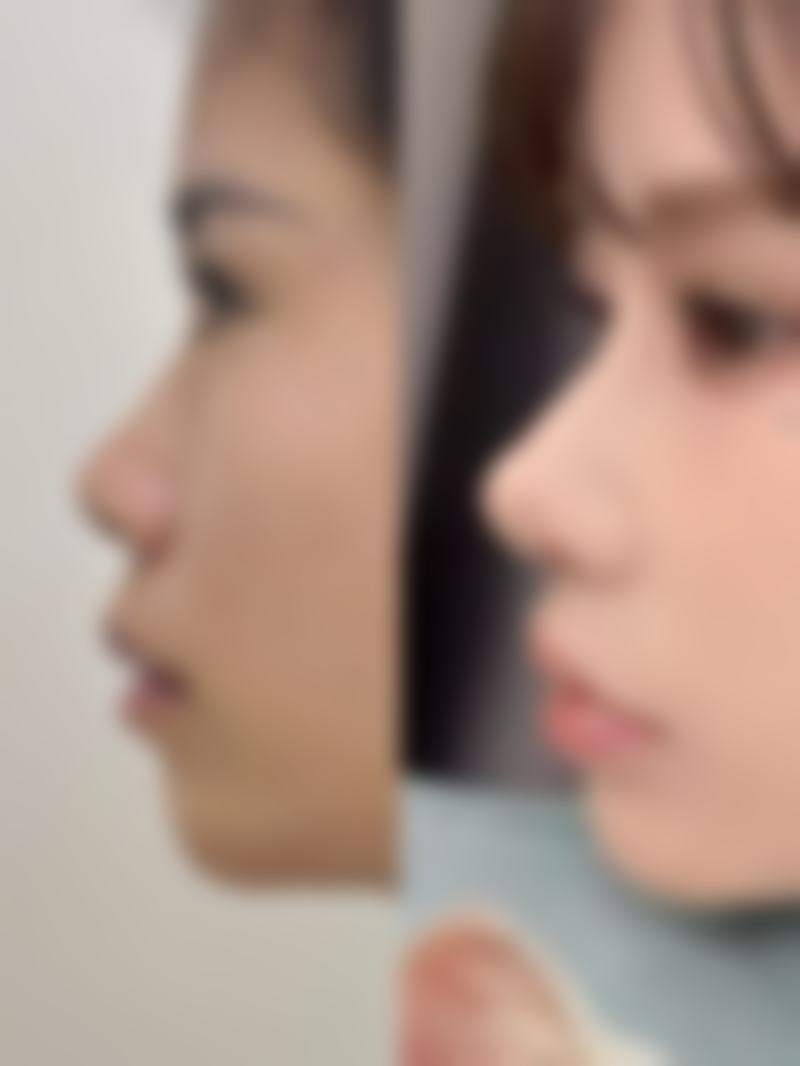 韩国雅佳整形医院简介概述