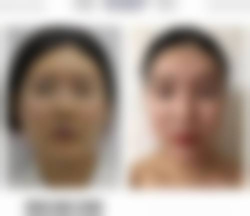 贵阳康馨医疗美容诊所求美者反馈