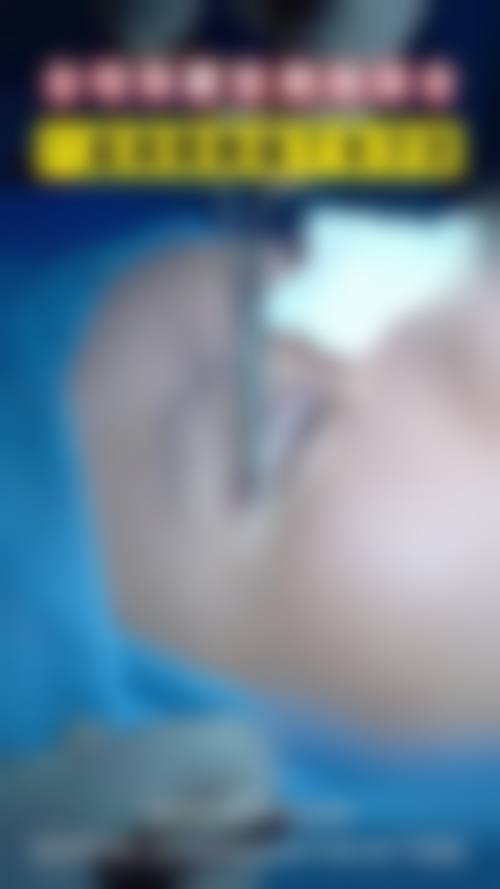 宝鸡维美大眼睛医美门诊部特色项目及技术优势