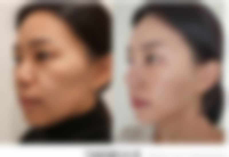 徐州艾优美紫馨整形医院价格收费