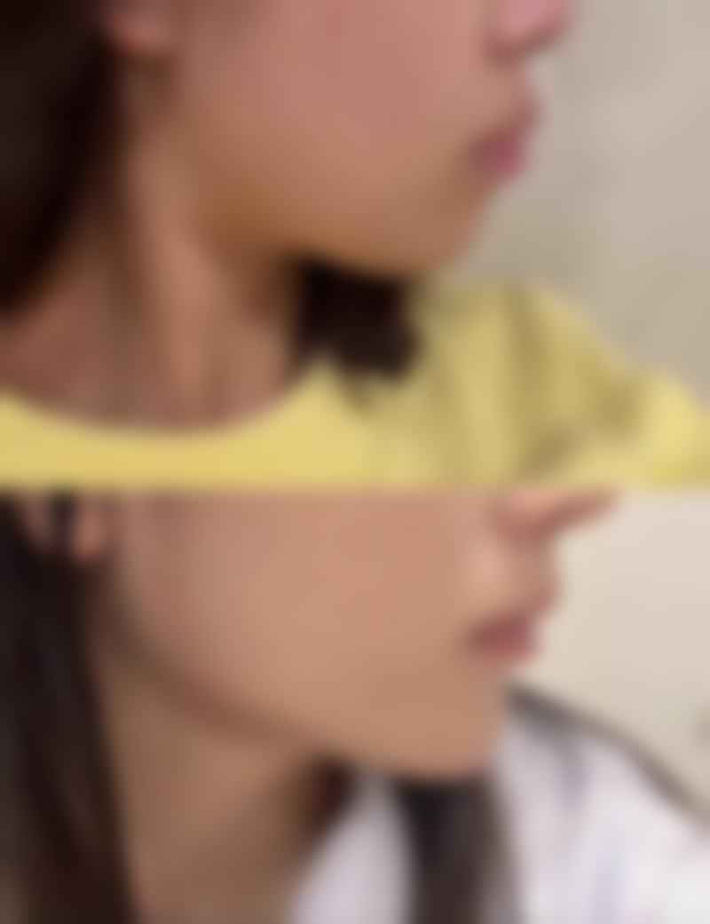 徐州艾优美紫馨整形医院特色项目及技术优势