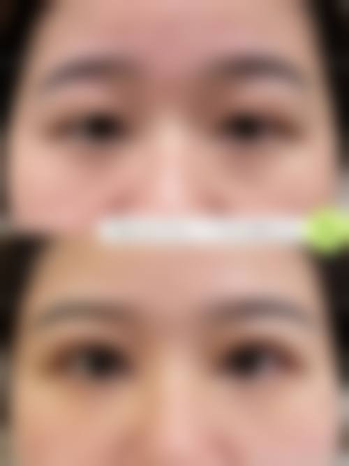 韩国芭堂整形外科医院求美者反馈