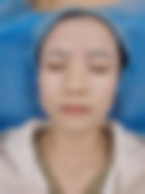 胡秀启医师坚持个性化定制，打造专属变得更美方案