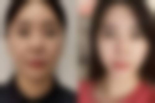 合肥爱春整形美容诊所求美者反馈