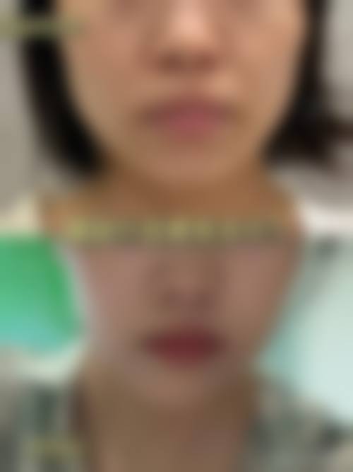 杨松林坚持个性化定制,拒绝千篇一律的医美方案