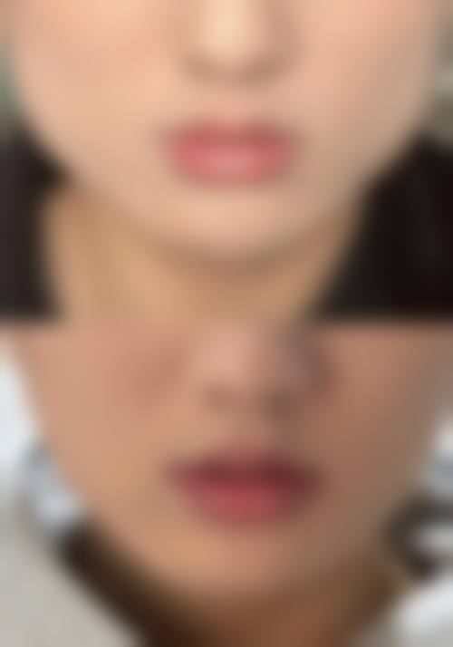广州恒美中颜医疗美容门诊部求美者反馈