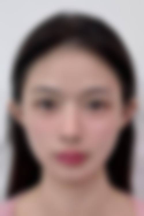 君綺診所(台北信義)求美者反馈