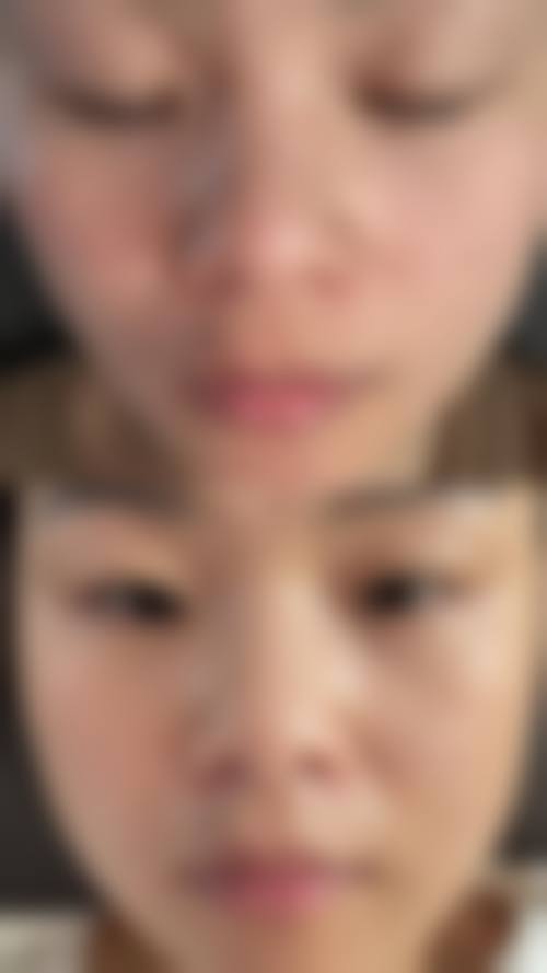 耿超主导的面部微整形:定制自然灵动的五法定案