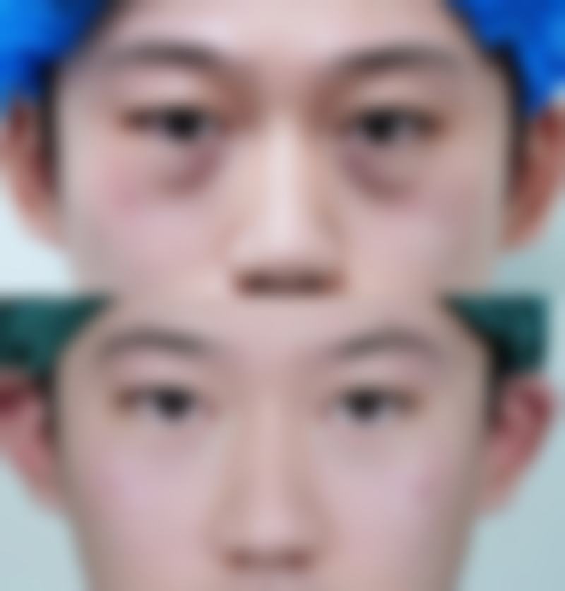 北京普蕊丰亭丰晓冰医疗美容诊所求美者反馈