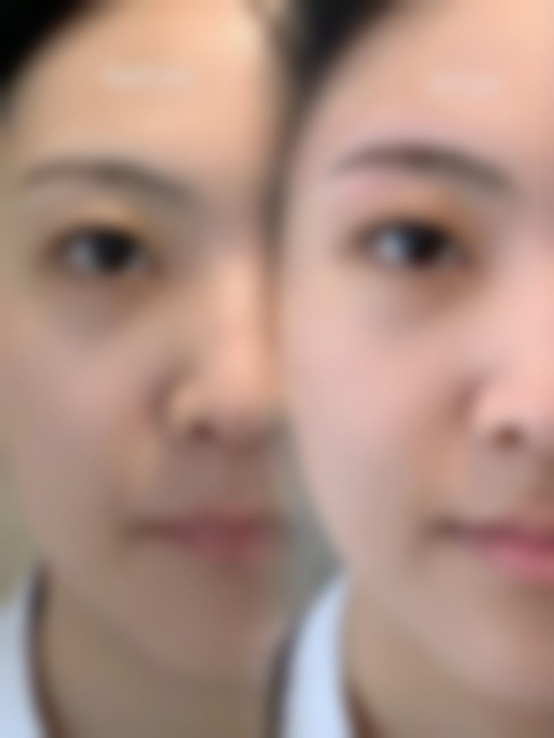 韩国BarbieFace整形医院求美者反馈
