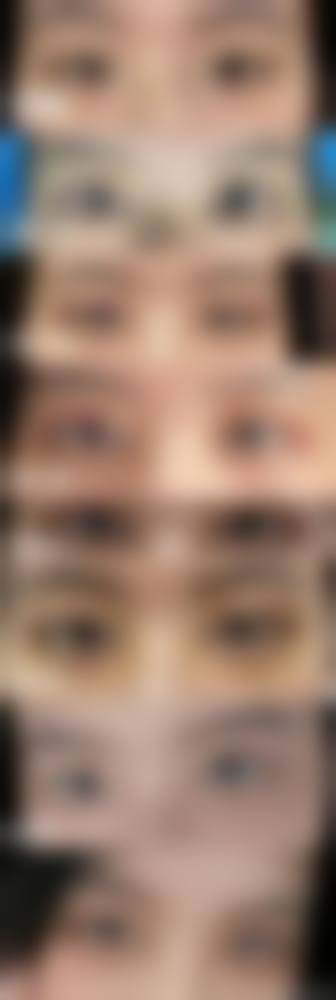 萍乡悦美整形医疗美容诊所求美者反馈
